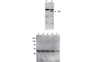 Western Blot testing of anti-BPV E2 DNaseI monoclonal antibody (5E11). (Bovine Papilloma Virus 1 E2 (BPV-1 E2) (AA 199-208) Antikörper)