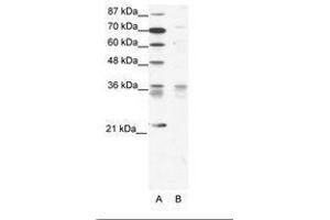 Image no. 1 for anti-BARX Homeobox 1 (BARX1) (AA 91-140) antibody (ABIN202088) (BARX1 Antikörper  (AA 91-140))