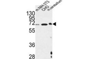 Western Blotting (WB) image for anti-Activating Transcription Factor 6 beta (ATF6B) antibody (ABIN3002237) (ATF6B Antikörper)
