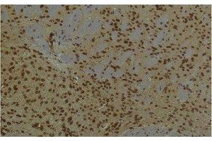 Immunohistochemistry of paraffin-embedded Mouse brain tissue using HIF1 bata Monoclonal Antibody at dilution of 1:200. (ARNT Antikörper)