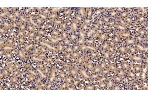 Detection of CBX3 in Mouse Kidney Tissue using Polyclonal Antibody to Chromobox Homolog 3 (CBX3) (CBX3 Antikörper  (AA 1-183))