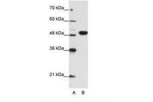 Image no. 1 for anti-Eukaryotic Translation Initiation Factor 4A2 (EIF4A2) (N-Term) antibody (ABIN6736193) (EIF4A2 Antikörper  (N-Term))