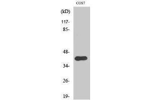 Western Blotting (WB) image for anti-V-Crk Sarcoma Virus CT10 Oncogene Homolog (Avian) (CRK) (pTyr221) antibody (ABIN3182415) (Crk Antikörper  (pTyr221))