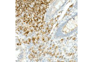 Immunohistochemistry of paraffin-embedded Human appendix using CD19 antibody (ABIN7266169) at dilution of 1:10000 (40x lens). (CD19 Antikörper)