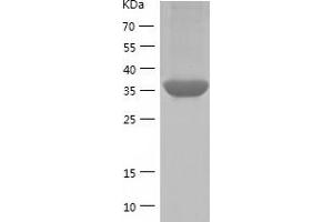 Western Blotting (WB) image for N-Acetylneuraminic Acid Synthase (NANS) (AA 1-359) protein (His tag) (ABIN7289000) (NANS Protein (AA 1-359) (His tag))