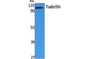 Western Blotting (WB) image for anti-Staphylococcal Nuclease Domain Containing Protein 1 (SND1) (Internal Region) antibody (ABIN3178115) (SND1 Antikörper  (Internal Region))