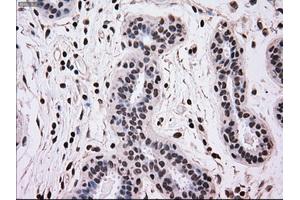 Immunohistochemical staining of paraffin-embedded breast tissue using anti-MRI1 mouse monoclonal antibody.