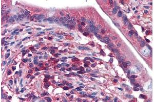 Human Small Intestine: Formalin-Fixed, Paraffin-Embedded (FFPE) (EDC4 Antikörper  (AA 1302-1402))