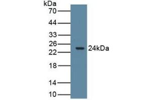 Western Blotting (WB) image for anti-Cytochrome P450, Family 19, Subfamily A, Polypeptide 1 (CYP19A1) (AA 196-373) antibody (ABIN7434821)