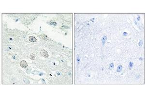 Immunohistochemistry analysis of paraffin-embedded human brain tissue, using JAK1 antibody. (JAK1 Antikörper  (N-Term))