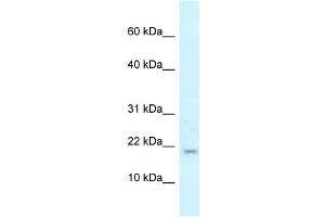 WB Suggested Anti-Rbm3 Antibody   Titration: 1. (RBM3 Antikörper  (N-Term))