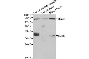 Western blot analysis of extracts of various cell lines, using BVES antibody (ABIN5970046) at 1/1000 dilution. (BVES Antikörper)