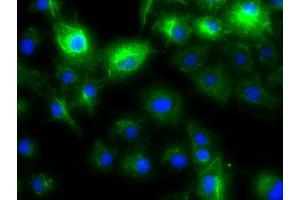 Anti-KRT8 mouse monoclonal antibody (ABIN2452366) immunofluorescent staining of COS7 cells transiently transfected by pCMV6-ENTRY KRT8 (RC209570). (KRT8 Antikörper  (AA 91-381))