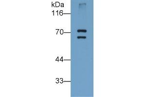 Detection of PADI6 in Human Placenta lysate using Monoclonal Antibody to Peptidyl Arginine Deiminase Type VI (PADI6) (PADI6 Antikörper  (AA 393-694))