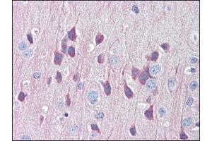 Image no. 3 for anti-Lysosomal-Associated Membrane Protein 1 (LAMP1) (Center) antibody (ABIN303277) (LAMP1 Antikörper  (Center))