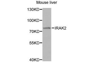 Western blot analysis of extracts of mouse liver, using IRAK2 antibody (ABIN1873258) at 1:1000 dilution. (IRAK2 Antikörper)