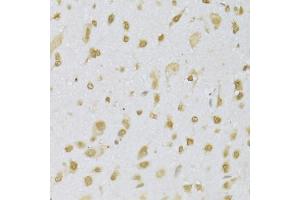 Immunohistochemistry of paraffin-embedded mouse brain using CBX8 Antibody (ABIN5973663) at dilution of 1/100 (40x lens).