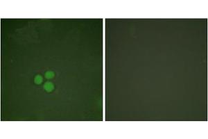 Immunofluorescence analysis of HeLa cells, treated with Forskolin (40nM, 30mins), using DP-1 antibody. (TGM4 Antikörper  (C-Term))