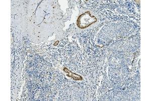 IHC analysis of VCL using anti-VCL antibody (ABIN7599003).