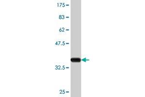 Western Blotting (WB) image for anti-Cytochrome P450, Family 24, Subfamily A, Polypeptide 1 (CYP24A1) (AA 415-514) antibody (ABIN514852)