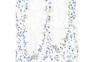 Immunohistochemistry (IHC) image for anti-Breast Cancer Metastasis Suppressor 1 (BRMS1) (AA 90-210) antibody (ABIN7265929)