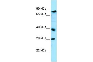 WB Suggested Anti-BRAT1 Antibody Titration: 1. (BAAT1 Antikörper  (C-Term))