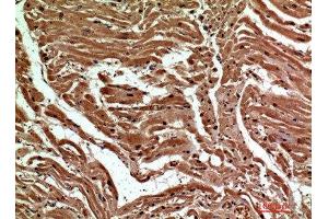 Immunohistochemistry (IHC) image for anti-C-Type Lectin Domain Family 6, Member A (CLEC6A) (Internal Region) antibody (ABIN7186528)