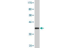 Western Blot detection against Immunogen (37. (PGBD1 Antikörper  (AA 241-350))