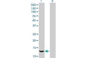 Western Blot analysis of HSPC152 expression in transfected 293T cell line by HSPC152 monoclonal antibody (M09), clone 3E5. (TRMT112 Antikörper  (AA 1-125))