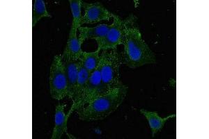 Immunofluorescent analysis of Hela cells using ABIN7176612 at dilution of 1:100 and Alexa Fluor 488-congugated AffiniPure Goat Anti-Rabbit IgG(H+L) (ZKSCAN3 Antikörper  (AA 8-275))