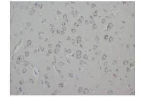 Immunohistochemical analysis of Paraffin-Embedded Rat Tissue Brain Sections using GAP43 antibody (GAP43 Antikörper  (C-Term))