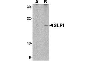 Western Blotting (WB) image for anti-Secretory Leukocyte Peptidase Inhibitor (SLPI) (Middle Region) antibody (ABIN1031101)