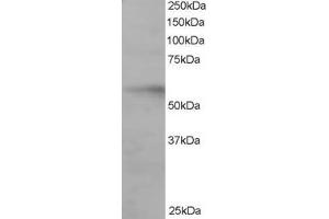 Western Blotting (WB) image for anti-Interferon Regulatory Factor 6 (IRF6) (C-Term) antibody (ABIN2465855) (IRF6 Antikörper  (C-Term))