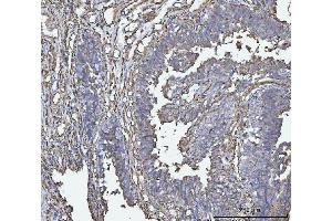 IHC analysis of HLA-DRA using anti-HLA-DRA antibody (ABIN7600949). (HLA-DRA Antikörper  (AA 26-254))