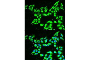 Immunofluorescence analysis of A549 cell using KLK10 antibody. (Kallikrein 10 Antikörper)