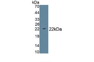 Detection of Recombinant CD276, Human using Monoclonal Antibody to Cluster Of Differentiation 276 (CD276) (CD276 Antikörper  (AA 47-219))
