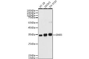 Western Blotting (WB) image for anti-Guanine Nucleotide Binding Protein (G Protein), beta Polypeptide 3 (GNB3) (AA 1-230) antibody (ABIN1680055)