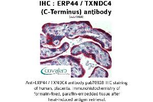 Image no. 2 for anti-Endoplasmic Reticulum Protein 44 (ERP44) (C-Term) antibody (ABIN1734140) (ERP44 Antikörper  (C-Term))