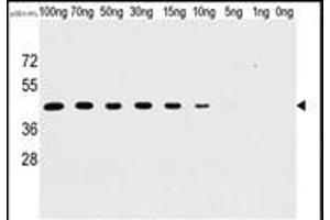 Western blot analysis of anti-H1L Mab (SG071115B) in recombinant pGEX-H1L protein. (Tyr/ser Protein Phosphatase Antikörper)