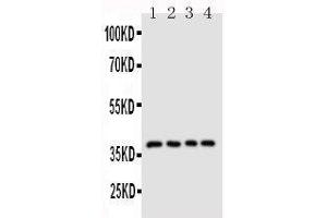 Anti-CD1d antibody, Western blotting Lane 1: COLO320 Cell Lysate Lane 2: HELA Cell Lysate Lane 3:  Cell Lysate Lane 4: JURKAT Cell Lysate (CD1d Antikörper  (N-Term))
