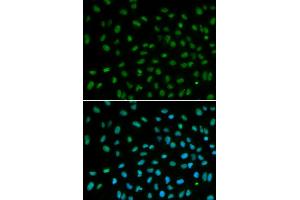 Immunofluorescence analysis of MCF-7 cells using DDB2 antibody (ABIN5970947). (DDB2 Antikörper)