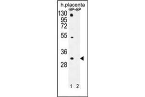 Western blot analysis of OR1D5 Antibody (C-term) Cat. (OR1D5 Antikörper  (C-Term))
