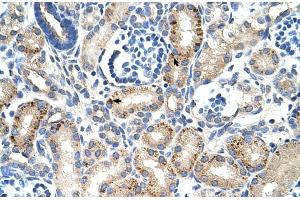 Rabbit Anti-MUC1 Antibody ,Paraffin Embedded Tissue: Human Kidney  Cellular Data: Epithelial cells of renal tubule  Antibody Concentration: 4. (MUC1 Antikörper  (C-Term))