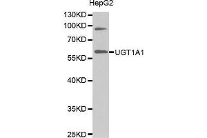 Western Blotting (WB) image for anti-UDP Glucuronosyltransferase 1 Family, Polypeptide A1 (UGT1A1) (AA 1-200) antibody (ABIN1683210) (UGT1A1 Antikörper  (AA 1-200))