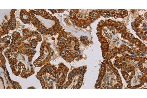 Immunohistochemistry (Paraffin-embedded Sections) (IHC (p)) image for anti-NADH Dehydrogenase (Ubiquinone) Fe-S Protein 5, 15kDa (NADH-Coenzyme Q Reductase) (NDUFS5) antibody (ABIN7237496)