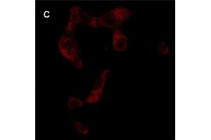 Detection of cathepsin B (CB) activity in Eca-109 cells by the CB probe. (Ziege anti-Kaninchen IgG Antikörper (FITC))