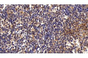 Detection of FAS in Porcine Lymph node Tissue using Polyclonal Antibody to Factor Related Apoptosis (FAS) (FAS Antikörper)