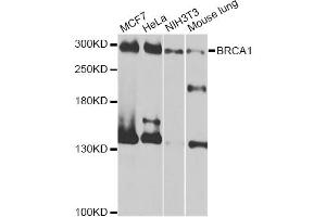 Western blot analysis of extracts of various cell lines, using BRCA1 antibody (ABIN5997316) at 1/1000 dilution. (BRCA1 Antikörper)