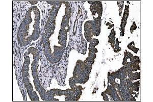 IHC analysis of TGFBR2 using anti-TGFBR2 antibody (ABIN7603157).