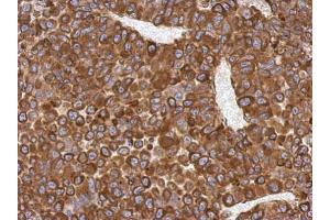 IHC-P Image Immunohistochemical analysis of paraffin-embedded PC13 xenograft, using AGR3, antibody at 1:500 dilution. (AGR3 Antikörper  (Center))